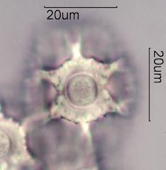 Chicory (Cichorium intybus) Pollen under the Microscope