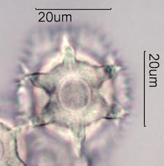 Chicory (Cichorium intybus) Pollen under the Microscope