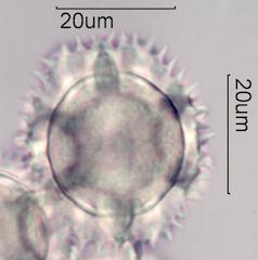 Chicory (Cichorium intybus) Pollen under the Microscope