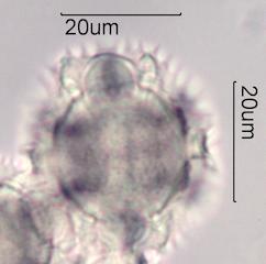 Chicory (Cichorium intybus) Pollen under the Microscope