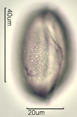 Chocolate Lily Pollen under the Microscope