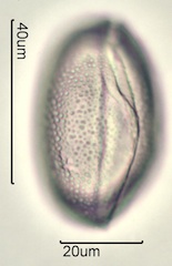 Chocolate Lily Pollen under the Microscope