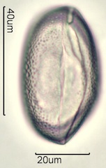 Chocolate Lily Pollen under the Microscope