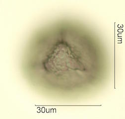 Cholla Cactus (Cylindropuntia sp.) Pollen