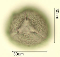 Cholla Cactus (Cylindropuntia sp.) Pollen
