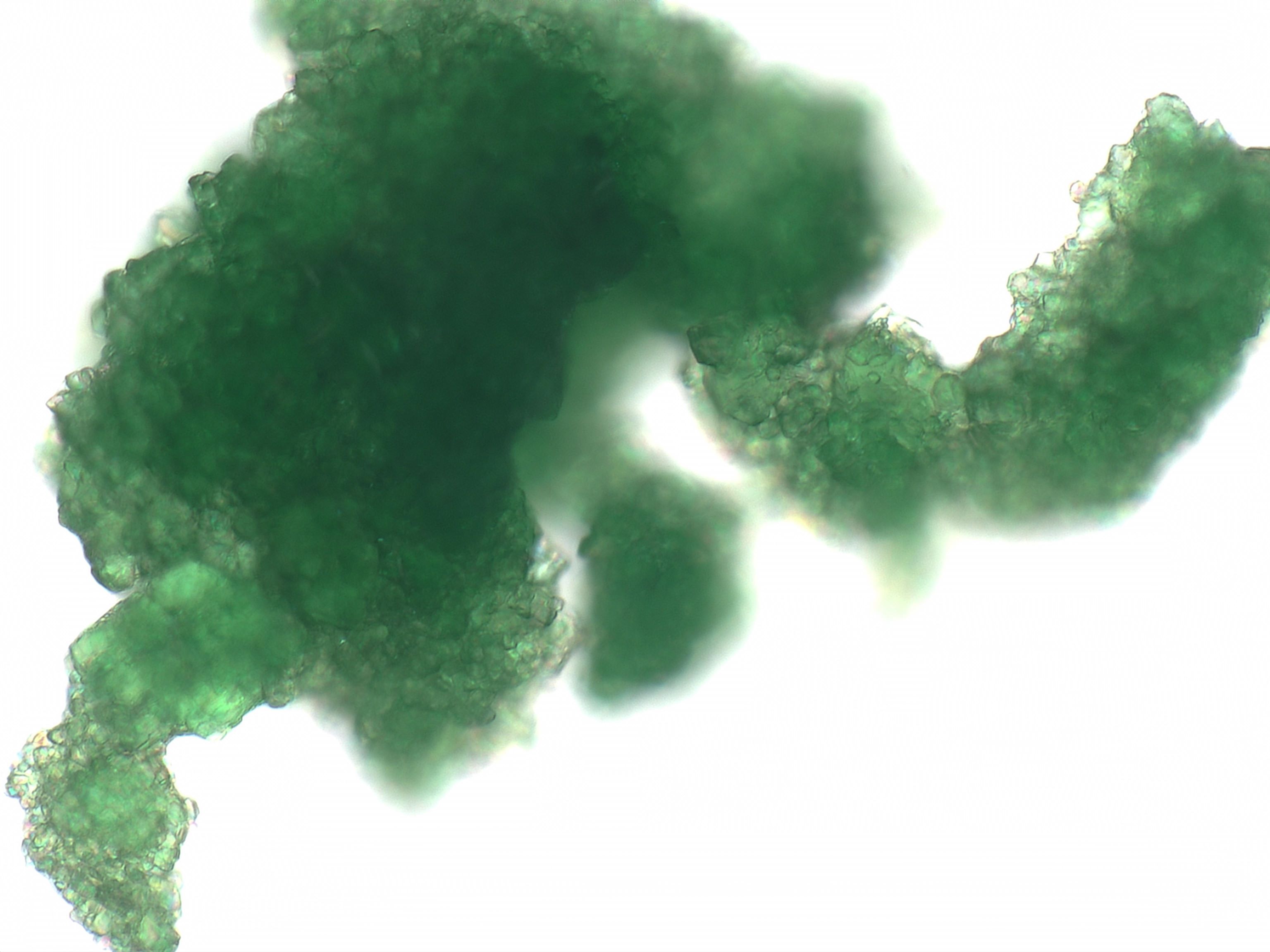 Chromium Chloride