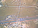 Chrysotile Asbestos