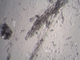 Chrysotile Asbestos