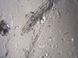 Chrysotile Asbestos