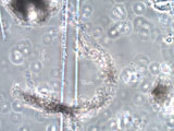 Chrysotile Asbestos