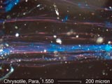 Darkfield Dispersion Staining