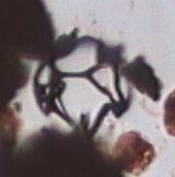 Circle-lacy Cenosphere