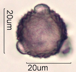 Cirsium sp. Pollen