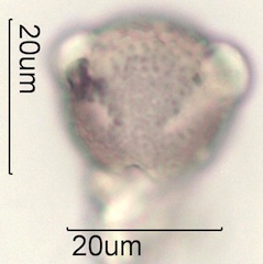 Cirsium sp. Pollen