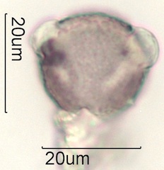 Cirsium sp. Pollen