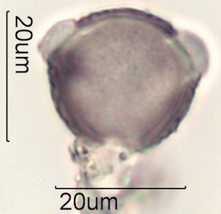Cirsium sp. Pollen
