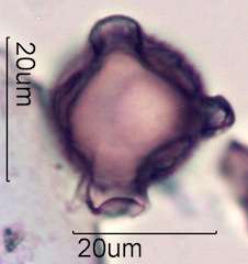 Cirsium sp. Pollen