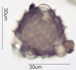 Cirsium sp. Pollen