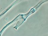 Cladophoria