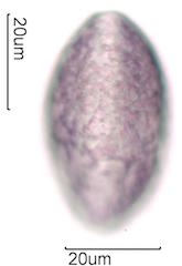 Hawaiian Honey Pollen Under the Microscope