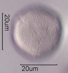 Hawaiian Honey Pollen Under the Microscope