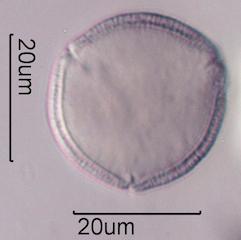 Hawaiian Honey Pollen Under the Microscope