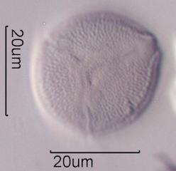 Hawaiian Honey Pollen Under the Microscope