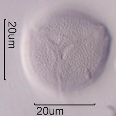 Hawaiian Honey Pollen Under the Microscope