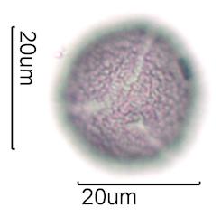 Hawaiian Honey Pollen Under the Microscope