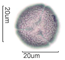 Hawaiian Honey Pollen Under the Microscope