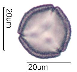 Hawaiian Honey Pollen Under the Microscope