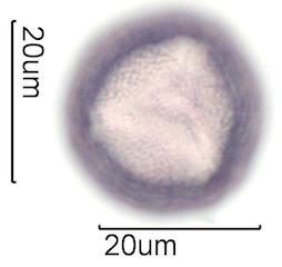 Hawaiian Honey Pollen Under the Microscope