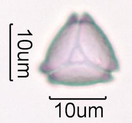 Hawaiian Honey Pollen Under the Microscope