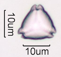 Hawaiian Honey Pollen Under the Microscope