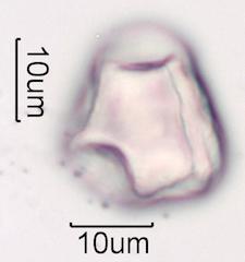 Hawaiian Honey Pollen Under the Microscope