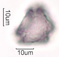Hawaiian Honey Pollen Under the Microscope