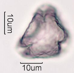 Hawaiian Honey Pollen Under the Microscope