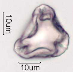 Hawaiian Honey Pollen Under the Microscope