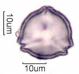 Hawaiian Honey Pollen Under the Microscope