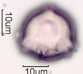 Hawaiian Honey Pollen Under the Microscope