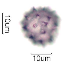 Hawaiian Honey Pollen Under the Microscope