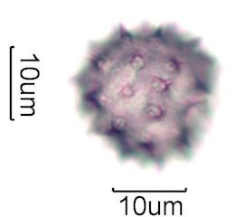 Hawaiian Honey Pollen Under the Microscope