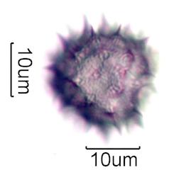 Hawaiian Honey Pollen Under the Microscope