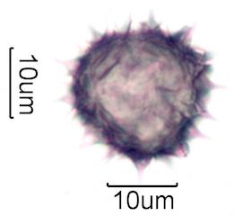 Hawaiian Honey Pollen Under the Microscope
