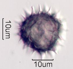 Hawaiian Honey Pollen Under the Microscope