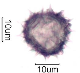 Hawaiian Honey Pollen Under the Microscope