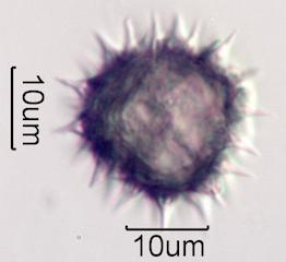 Hawaiian Honey Pollen Under the Microscope