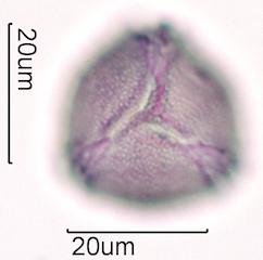 Hawaiian Honey Pollen Under the Microscope