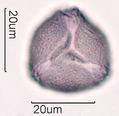 Hawaiian Honey Pollen Under the Microscope