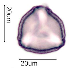 Hawaiian Honey Pollen Under the Microscope